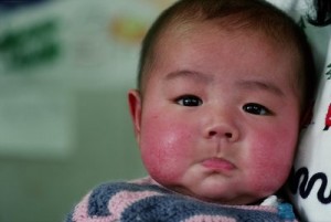 Closeup of a baby of Asian descent with serious eyes, a pursed mouth, and very red cheeks.