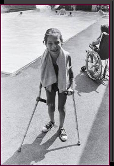 A young girl poolside, supported by hand braces.