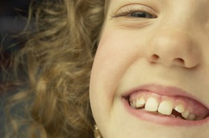 Closeup of a young girl with a huge smile.