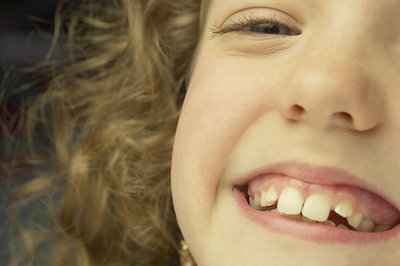 Closeup of a young girl with a huge smile. Foto de una joven con una sonrisa brillante.